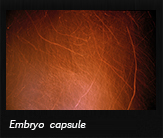 Embryo capsule
